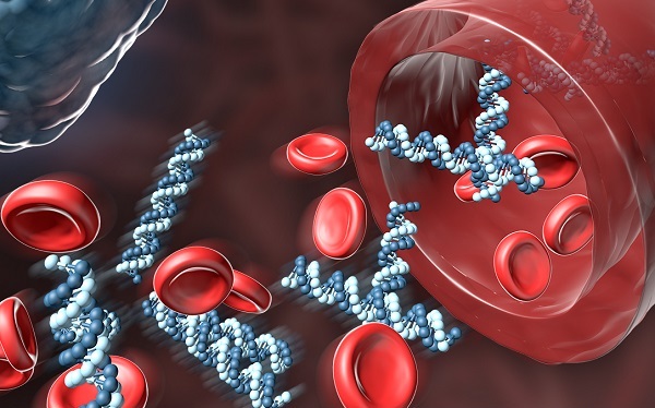 انواع مختلف آمیلوئیدوز و علائم آن 8 رگ قلب