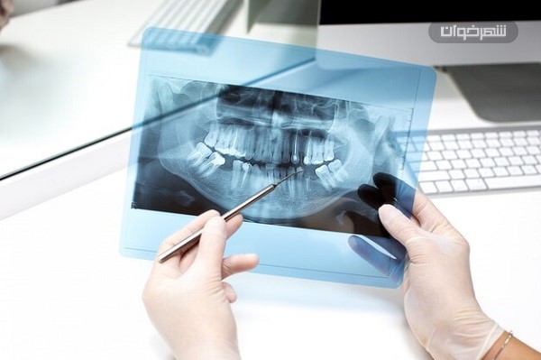 رادیولوژی دندان Dental radiology
